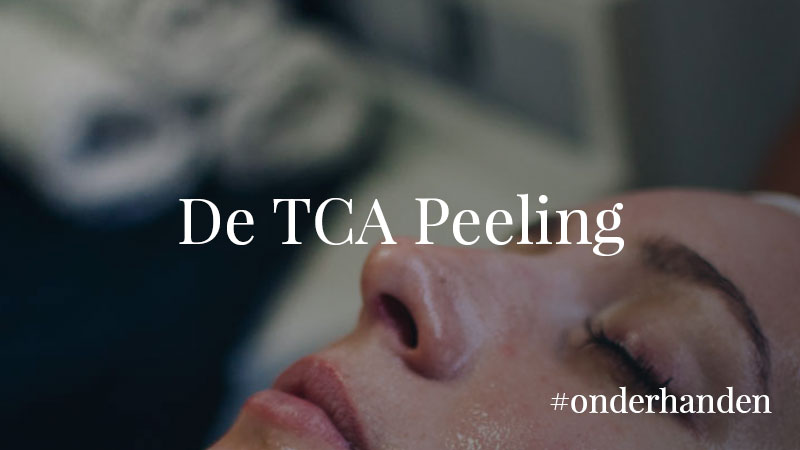 #onderhanden blogpost serie - TCA peeling