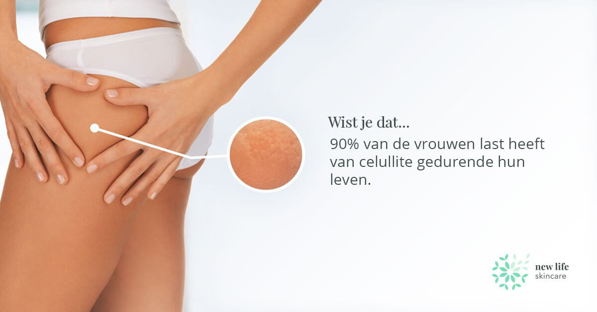 huidproblemen-cellulite
